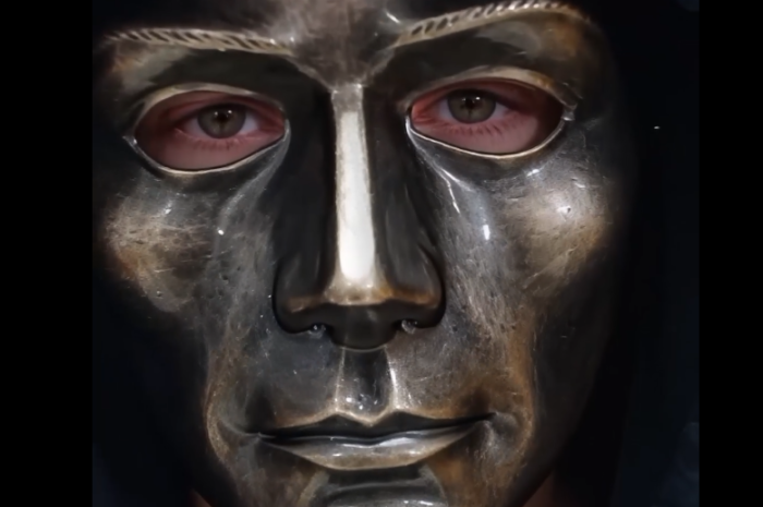 Nobody Knew Why This Boy Wore a Metal Mask